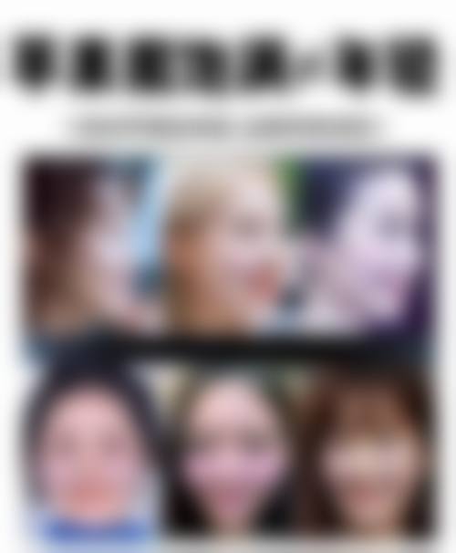 临床实例分享:Kenny医生苏州韩奥医疗美容诊所真实经历