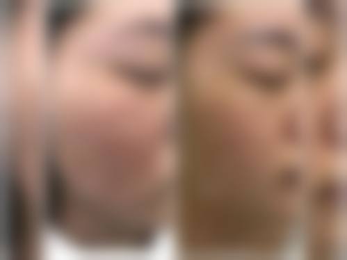 杭州悦可医疗美容诊所邹霞怎么预约面诊——新疆梁青松医疗美容诊所
