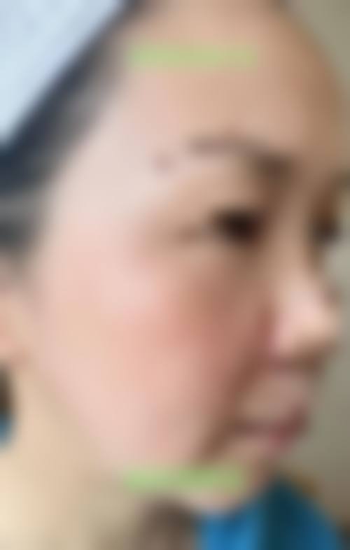 丽港丽格医疗美容门诊部顾客实例