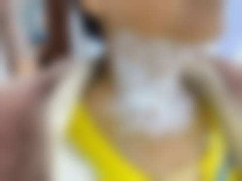 特色医疗项目:满足您的多样美丽需求