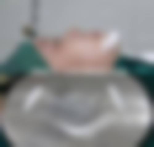 层流手术室与正版材料