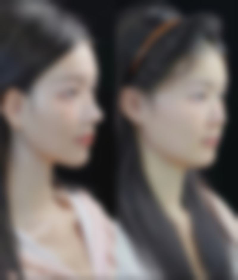 郑倞旻医生简介项目优势
