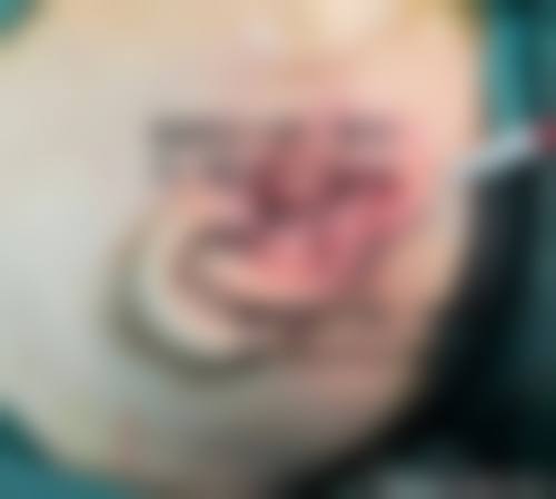 总结:为何选择哈尔滨再生医美整形医院
