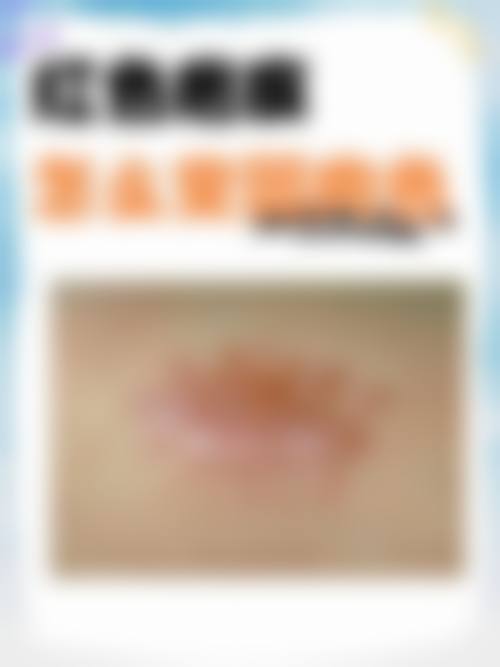 方慧琍医生简介项目优势