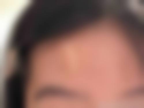 戴玉琳医生简介做手术价格