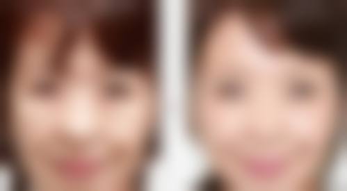 特色项目与个性化方案:激光美容与整形外科