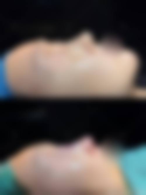 滨州张方超整形医院价格表