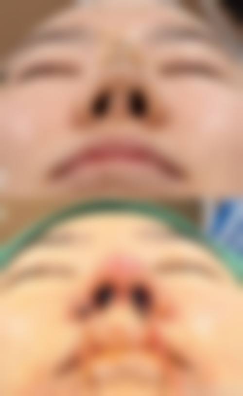 医生团队与专精保护:周密医生的技术优势