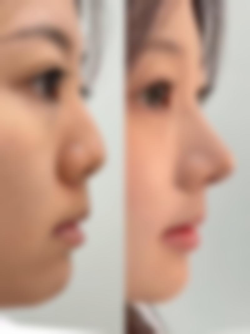 青岛丽人妇科医院口碑好不好?附真实患者口碑评价