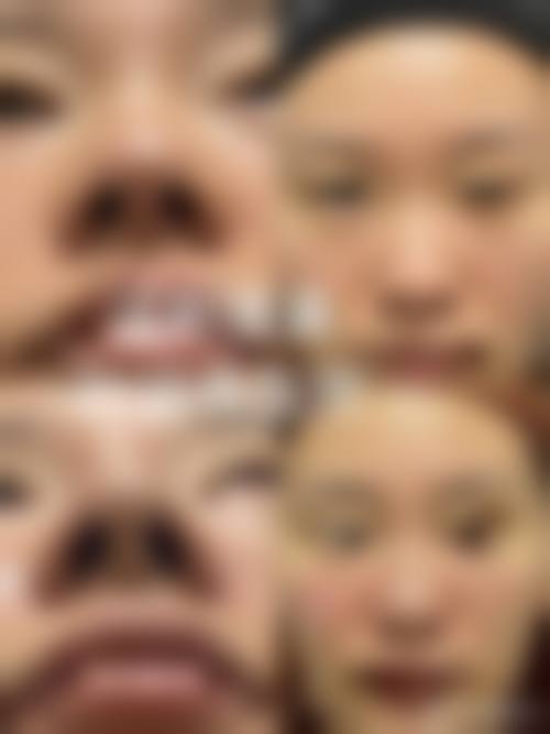 临床实例分享