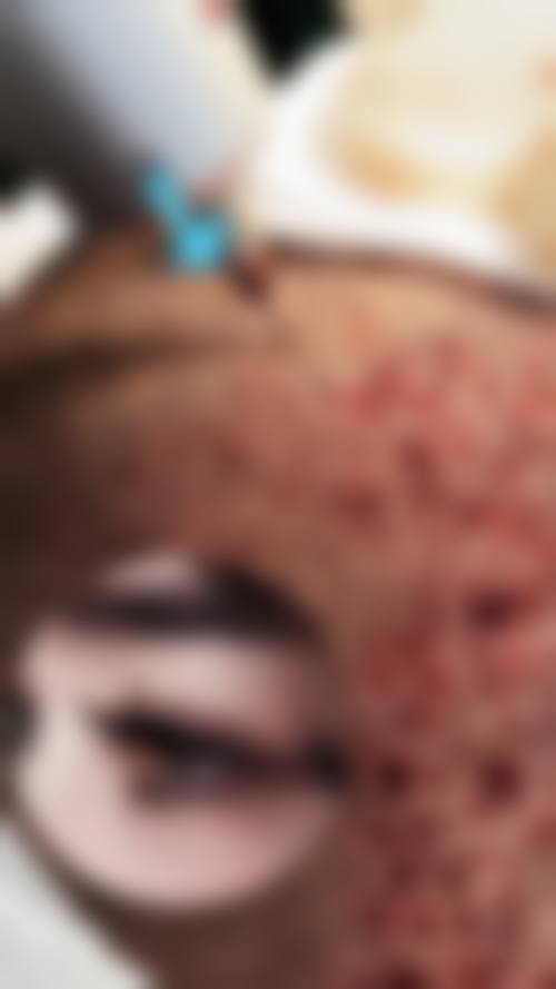 曹腾医生简介项目优势