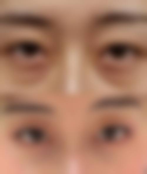 优惠活动详情:限时补贴,到店即享