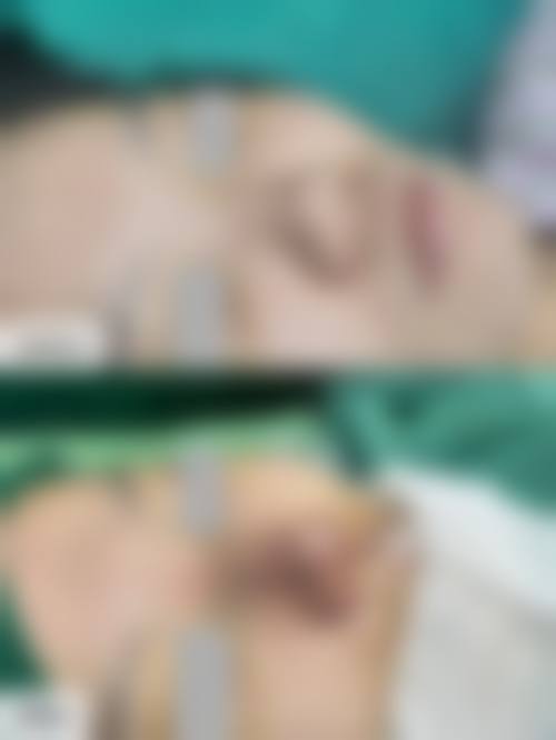 擅长项目详解