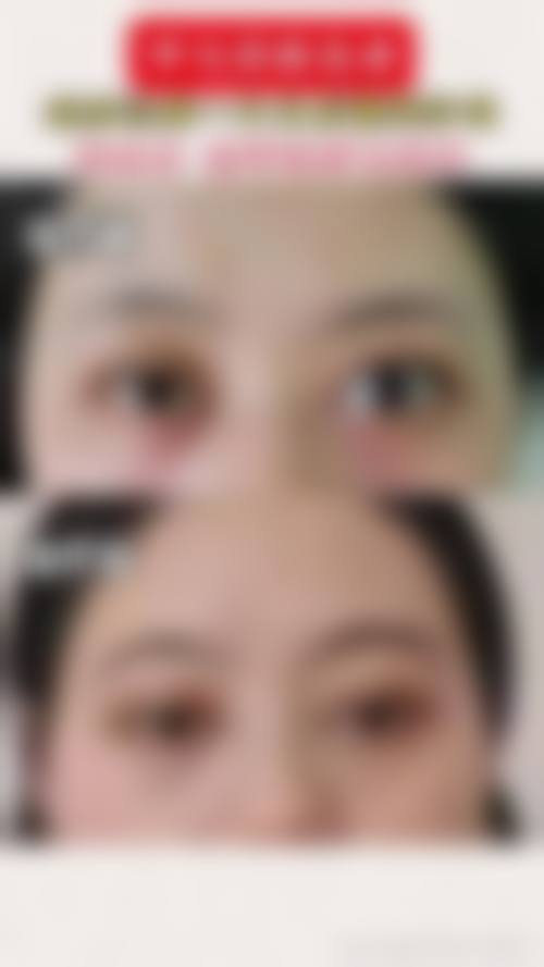 诊疗特色总结:中南大学湘雅医院眼科的诊疗优势