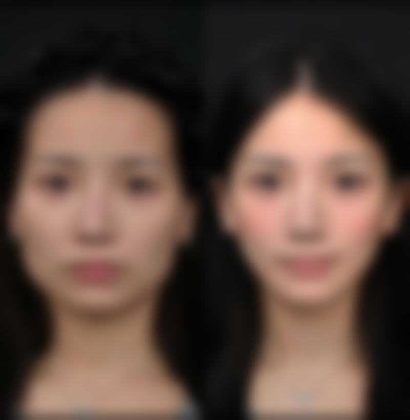 设备环境介绍:国内外前列硬件提升诊疗体验