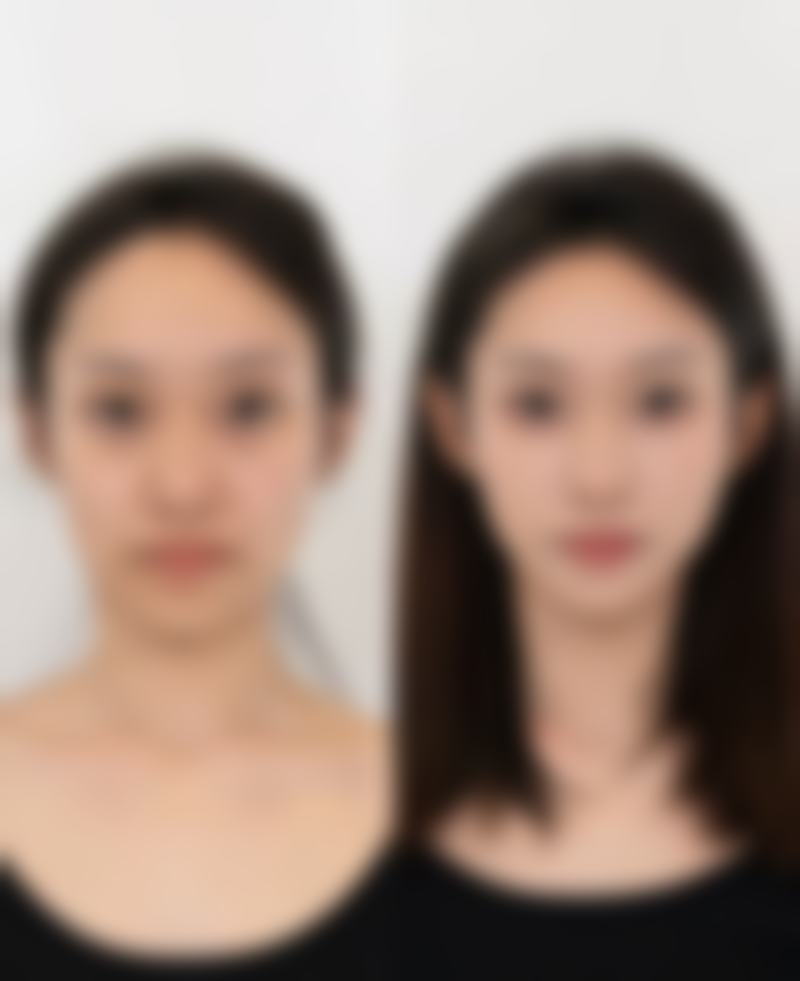俞律峰医生口碑如何