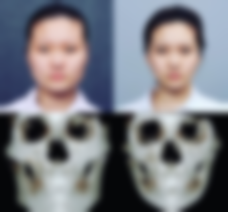 沈阳天使医疗美容整形诊所价格表