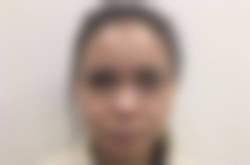 二、PPP肌肤管理中 心正规吗？这些细节为您解答
