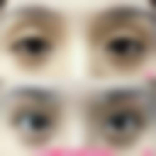 仝茂盛医生简介做手术价格