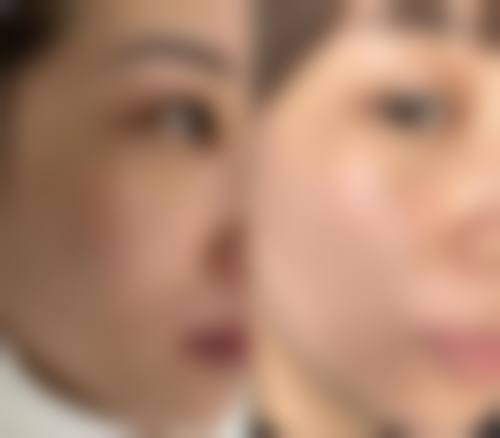 赖运泰医生项目优势