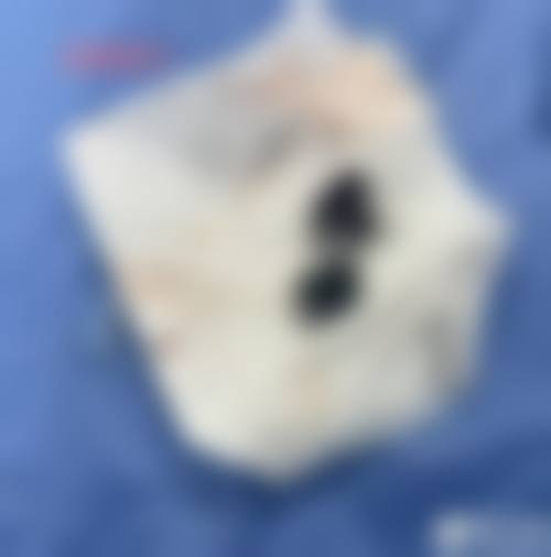 成都瑞美瑞亚整形医院价格表