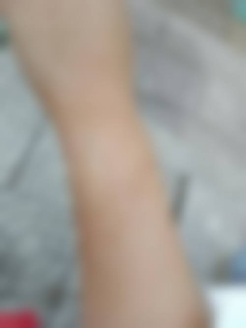 南部县人民医院(美容皮肤科)项目特色