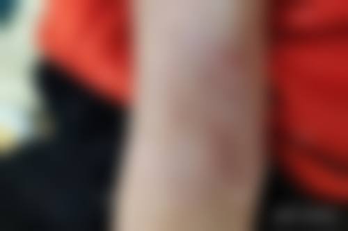 南部县人民医院(美容皮肤科)口碑好不好?附真实患者口碑评价