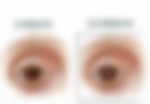 医院简介与就诊指南:中南大学湘雅医院眼科怎么样?