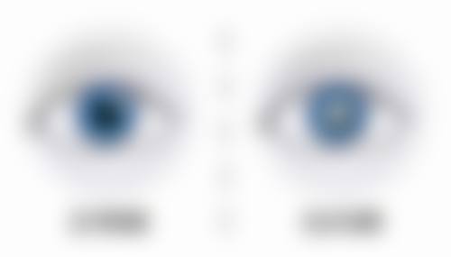 总结：为什么选择中南大学湘雅医院眼科的文丹医生？