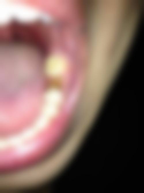 江西上饶德兴银城健齿口腔怎么样?正规吗?
