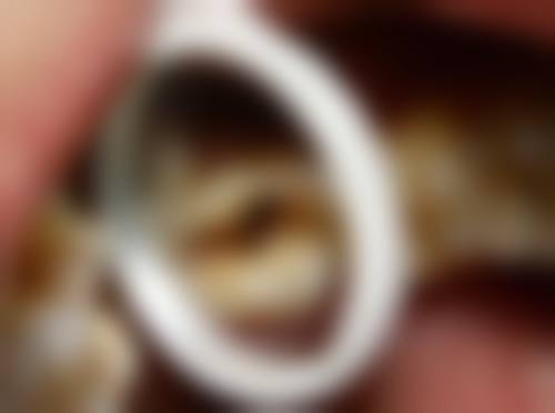麻涌维尔口腔门诊部怎么预约?挂号方便吗?