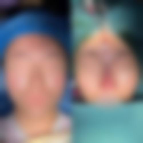 上海沃德医疗中 心医疗美容科抖音团购活动与价格表