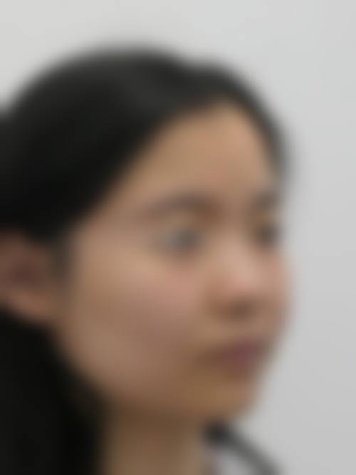 张晓萍医生项目优势