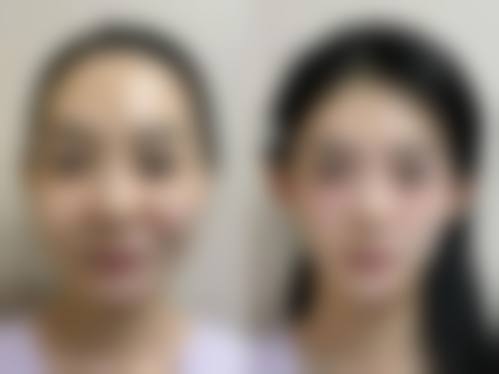 崔相哲医生简介口碑如何
