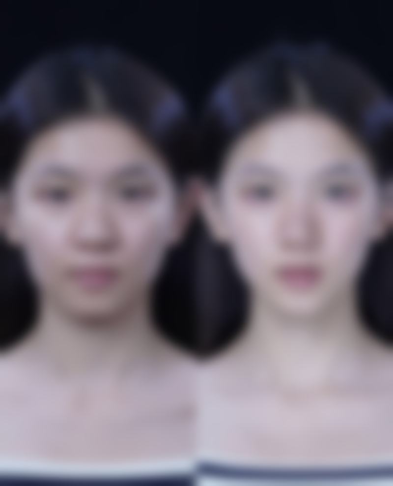 张家伟医生简介做手术价格