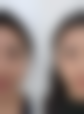 张家界瑞美整形怎么预约挂号?三种方式任你选