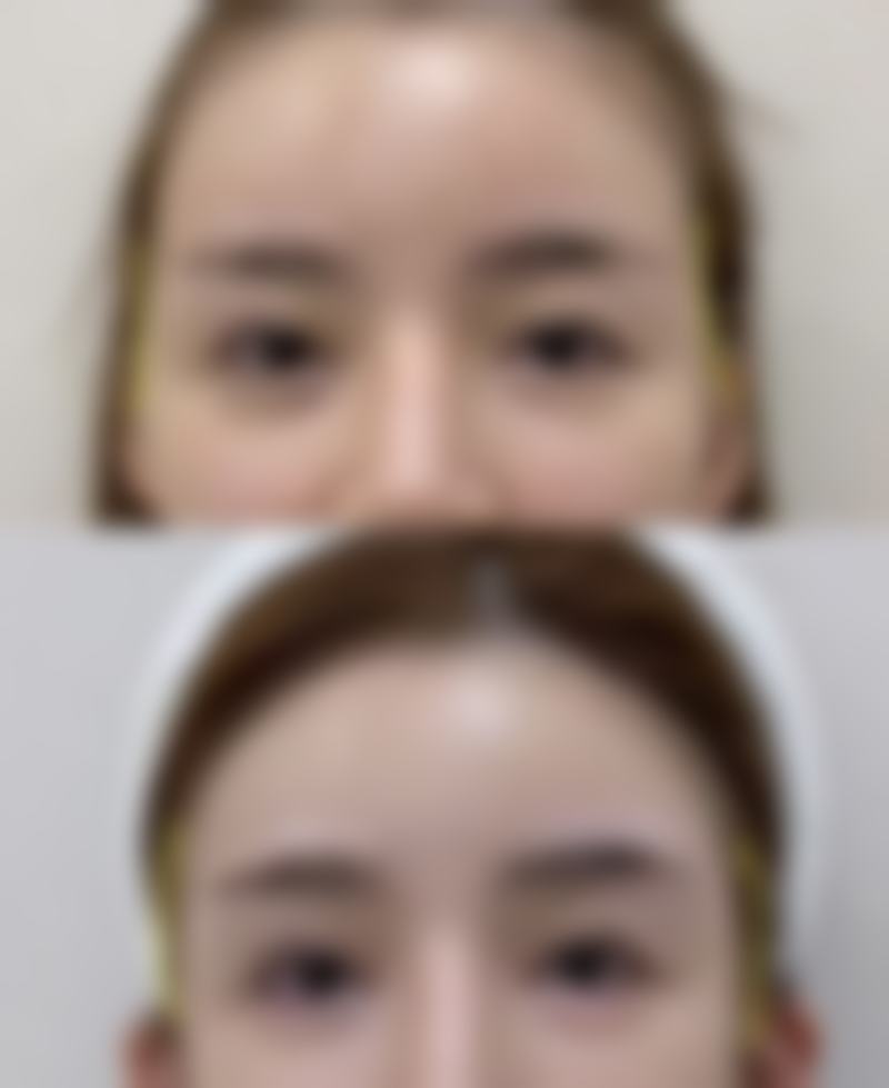 张家界瑞美整形正规吗?资质与实力双保险
