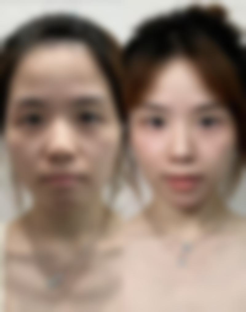 泰安嘉年华整形医院的技术优势有哪些?