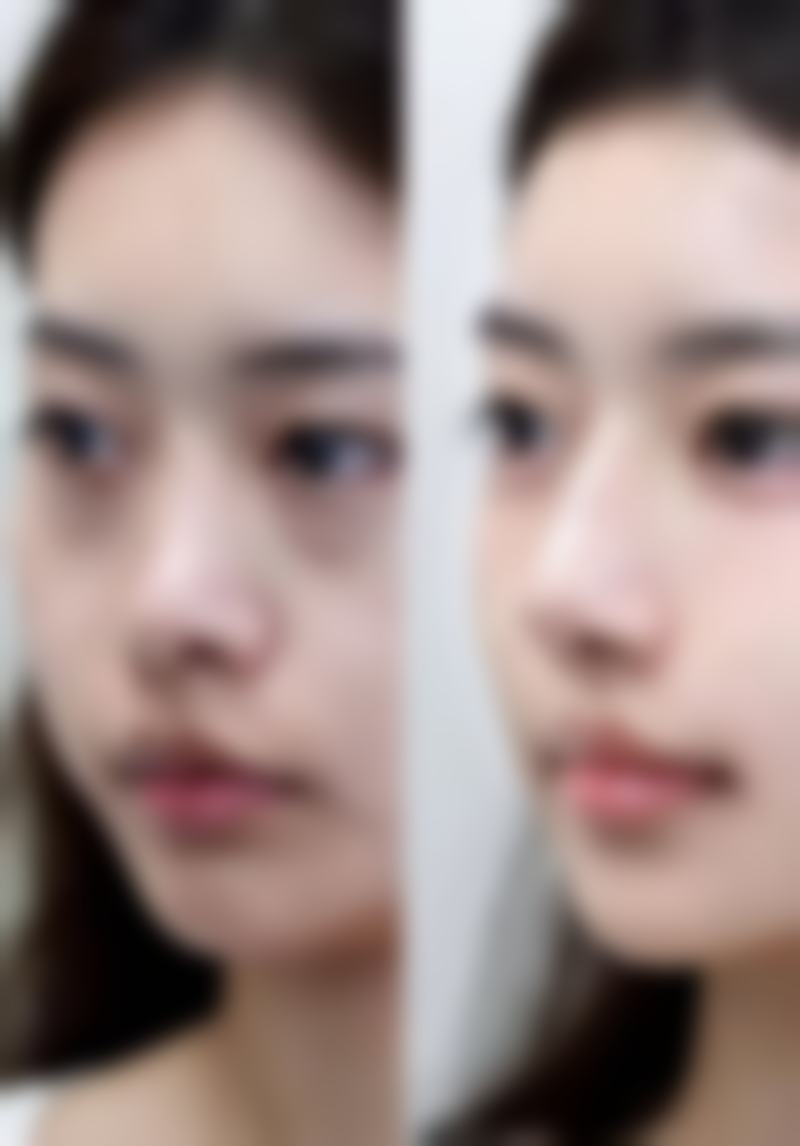 韩国清潭恩皮肤科是否正规